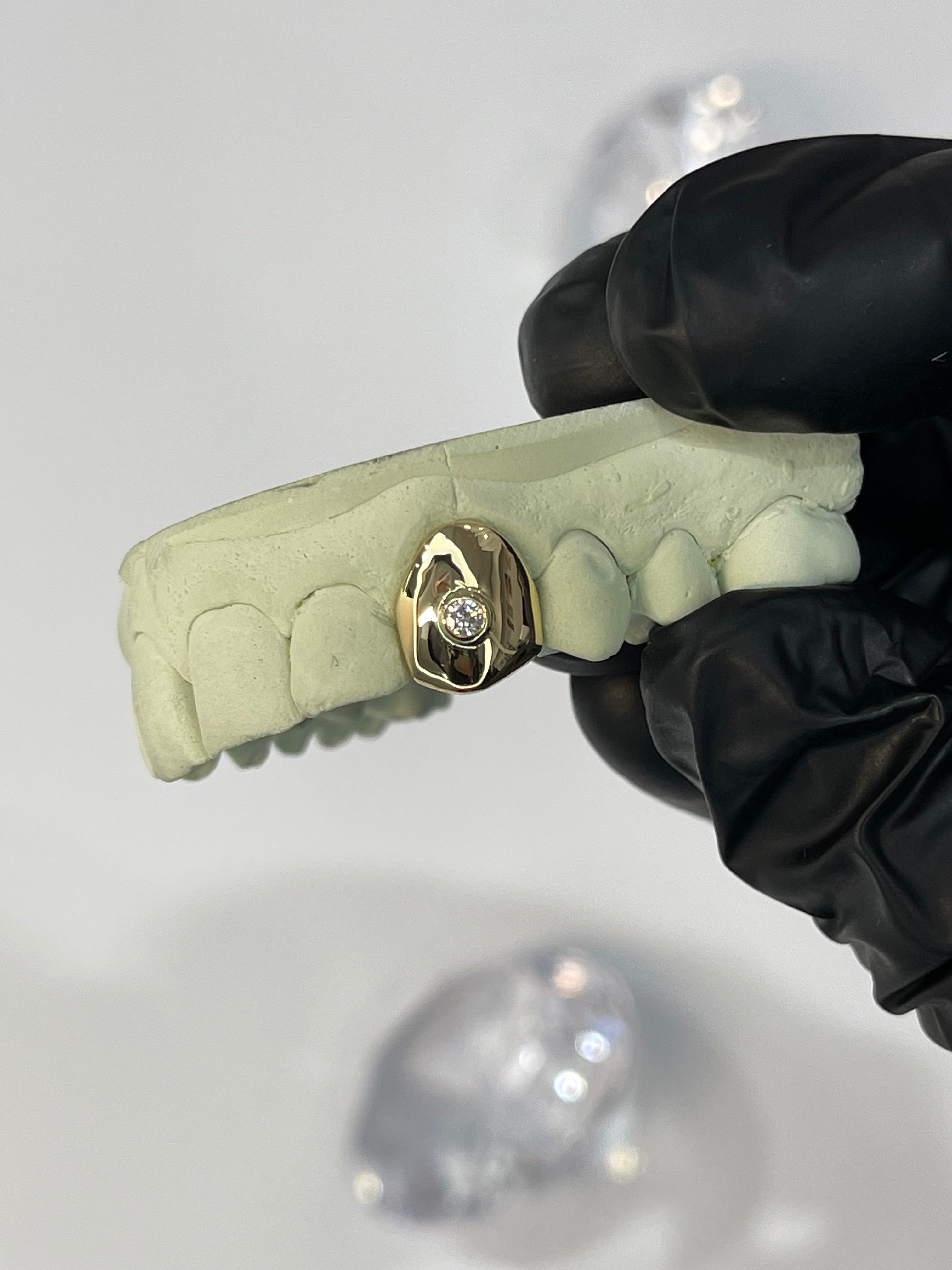 Single tooth with 1x diamond – Diamond Pearls